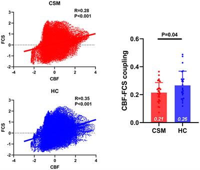 Altered Coupling Between Resting-State Cerebral Blood Flow and Functional Connectivity Strength in Cervical Spondylotic Myelopathy Patients
